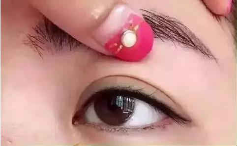 切双眼皮多少钱啊