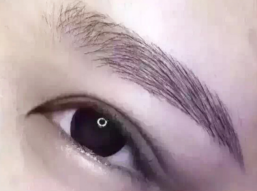 眼袋抽脂有危害吗
