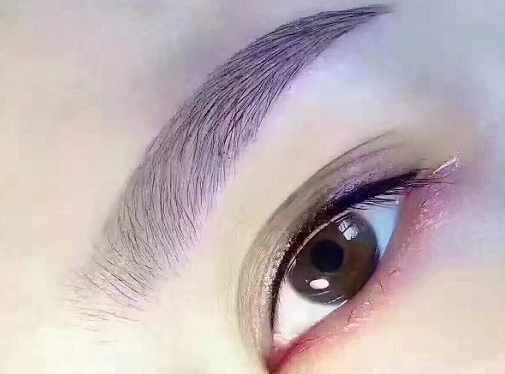埋线重睑术自然吗