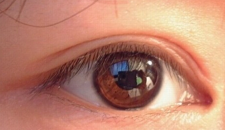 做开眼角手术对眼球会有伤害吗