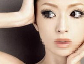 韩式开眼角效果无痕更自然吗
