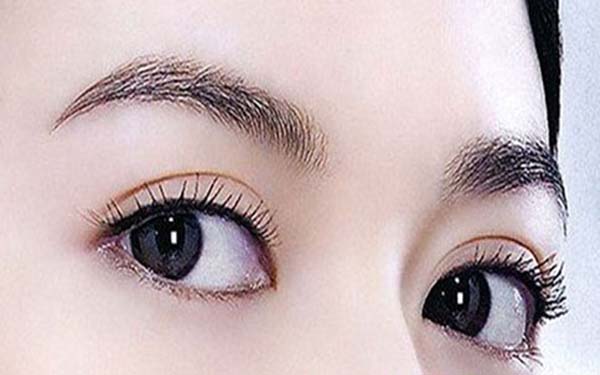 眼部抽脂后多久恢复