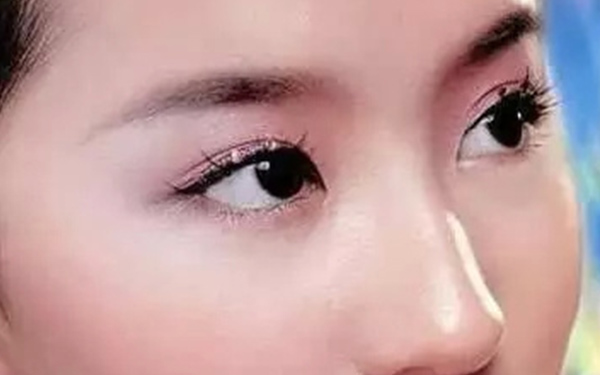 开眼角疤痕增生怎么去除