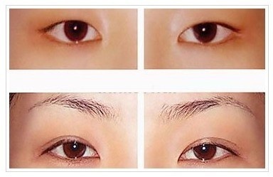 不适合开眼角眼型图片
