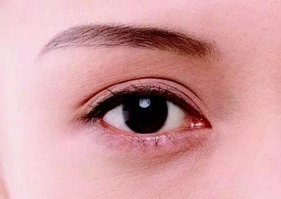 做双眼皮开内眼角术后护理怎么做好