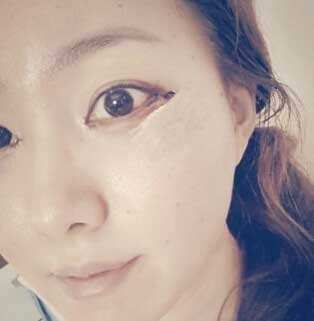 开外眼角疼痛的注意事项