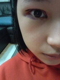 开内眼角手术后如何护理