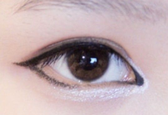 开内眼角术后的恢复过程要多久