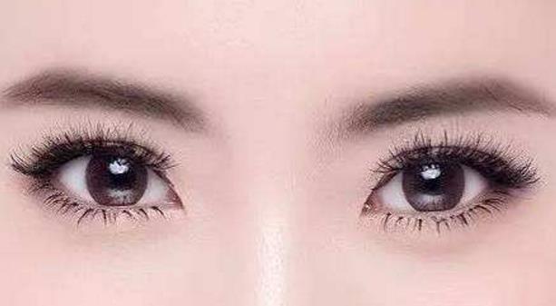 韩式开眼角是什么意思