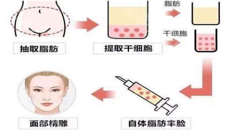 整形美容多少钱