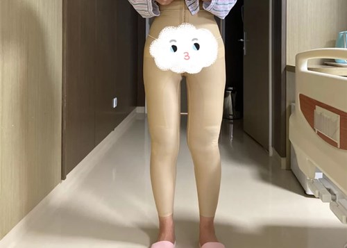 吸脂手术前后对比照片真人案例图