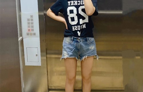 吸脂手术前后对比照片真人案例图