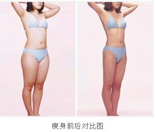 做吸脂瘦身有影响吗