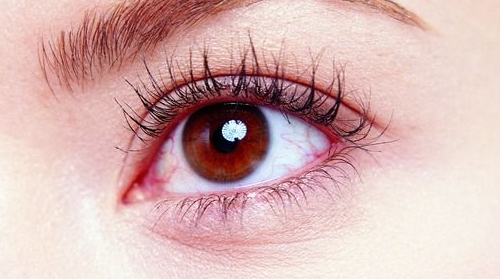 去眼袋黑眼圈的效果如何