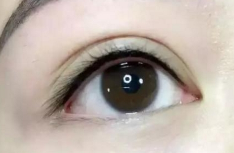 成都眼部修复医院哪里好