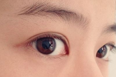 眼部修复是怎样的