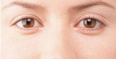 上海眼部修复贵吗