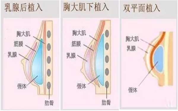 胸部过大的表现形式及缩小方法有哪些？