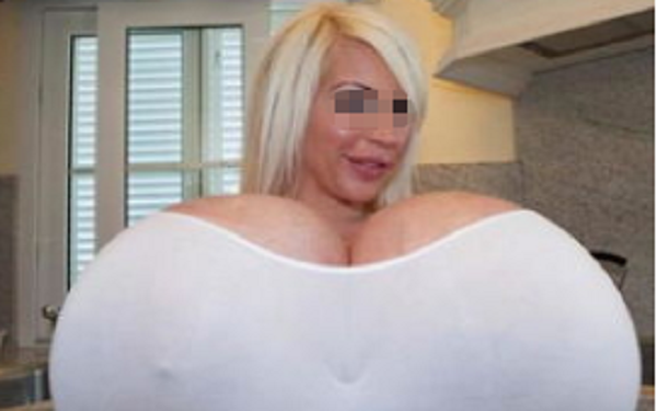 详解巨乳缩小术后注意事项