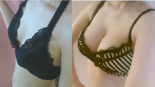 缩乳术是怎么做的?