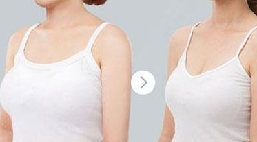 是否适合作乳房缩小整形