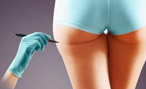 大腿吸脂后不能吃什么