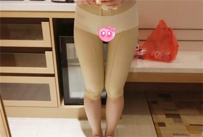腿部吸脂7天效果恢复图