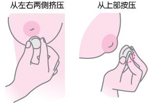 做乳头内陷矫正术哪家好