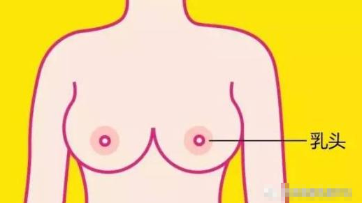 乳头凹陷症状和需要注意的问题