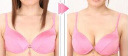 大乳房下垂整形多少钱
