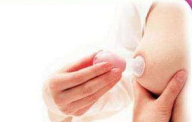 乳头内陷矫正并发症