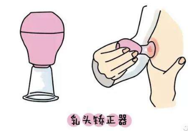 做乳头内陷矫正去哪里好