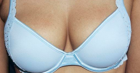 一般做乳房下垂矫正方法有哪些