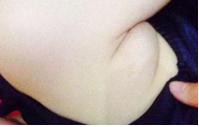 关于副乳的常识