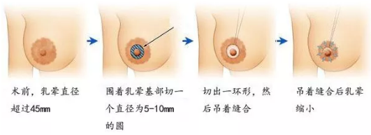 还在担心乳晕问题吗？粉嫩少女性就是现在！