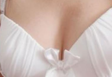 乳头缩小术具有危险吗