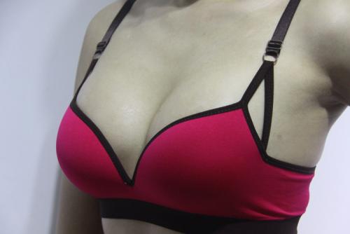 乳晕手术要几天拆线