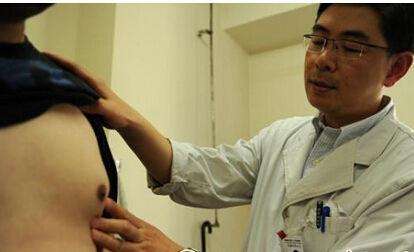 男子缩小乳头手术