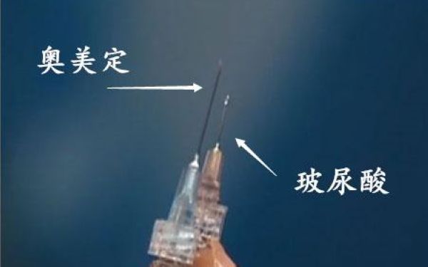 奥美定取出痛吗