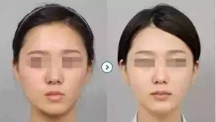 活细胞填充能保持多久