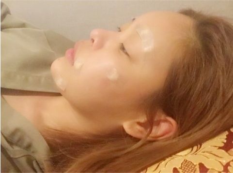 脸部脂肪填充后效果维持多久