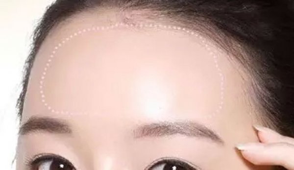 自体脂肪多久可以稳定