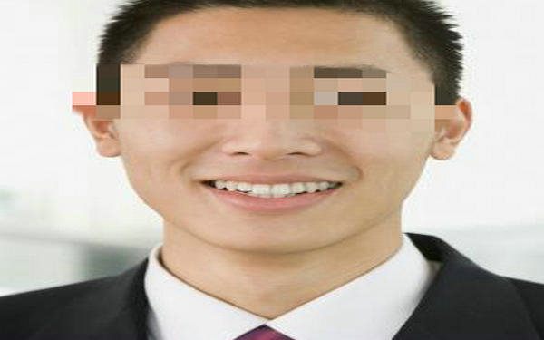 精索静脉曲张手术风险