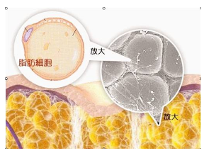嘴唇脂肪填充副作用
