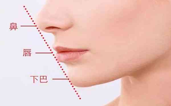 鼻孔缩小术后注意事项有哪些