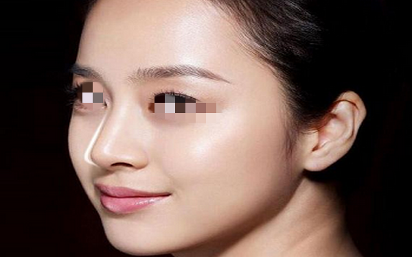 鼻翼大怎么整？