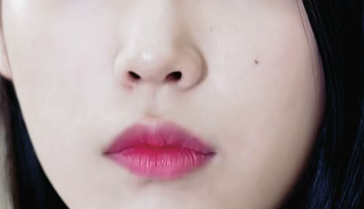 做驼峰鼻整形手术安全吗
