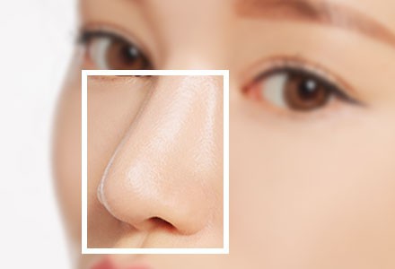鼻头肥大不好看，怎么做才能改善呢？