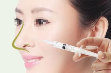 硅胶假体隆鼻加鼻中隔垫鼻尖加缩小鼻头的价格