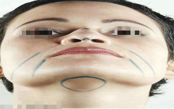 缩鼻孔多少钱